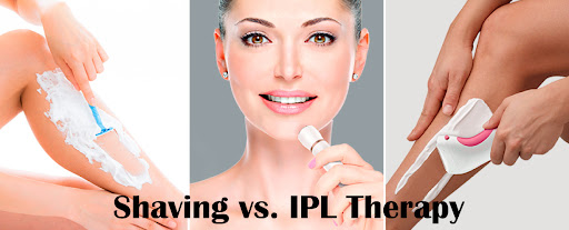 IPL Laser Hair Removal vs. Shaving